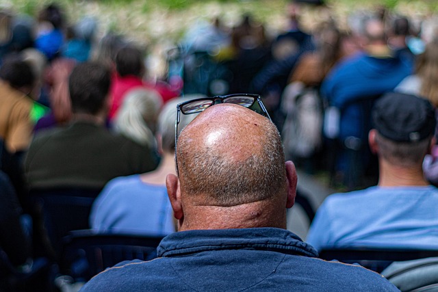 balding
