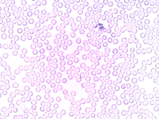 Hình ảnh minh họa ý nghĩa của từ erythrocyte