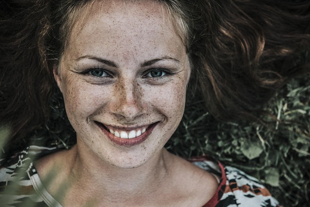 freckles