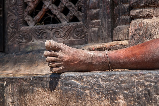 front leg