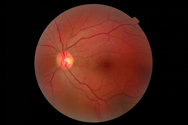 Hình ảnh minh họa ý nghĩa của từ fundus