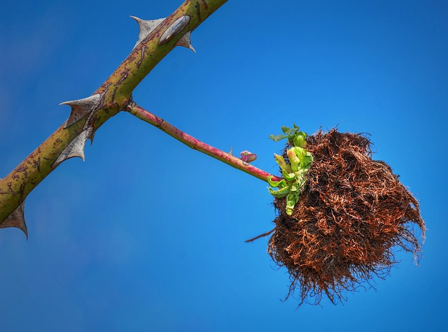 Hình ảnh minh họa ý nghĩa của từ gallstones
