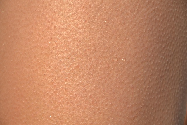gooseflesh