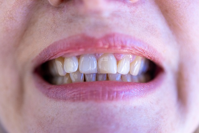 grit your teeth
