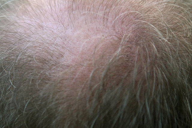 Hình ảnh minh họa ý nghĩa của từ hair follicle