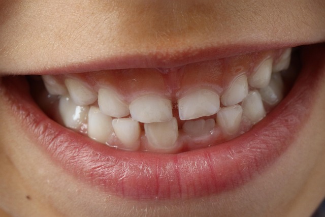 healthy gums