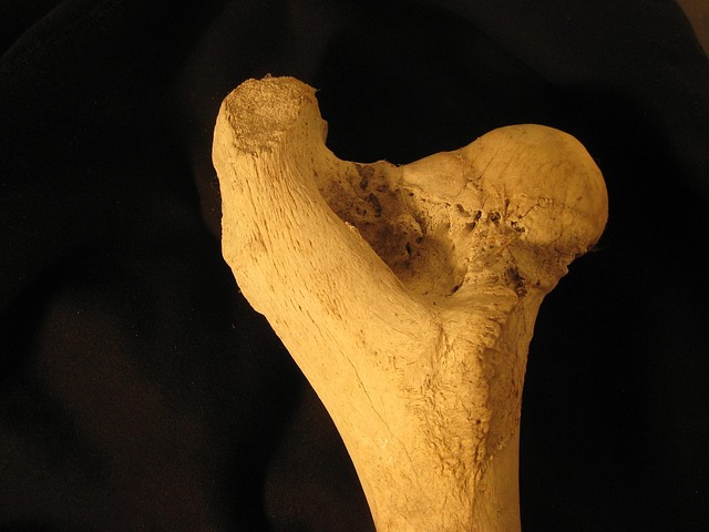 hip bone