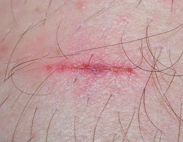 Hình ảnh minh họa ý nghĩa của từ injury time