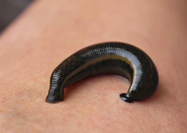 Hình ảnh minh họa ý nghĩa của từ leech therapy