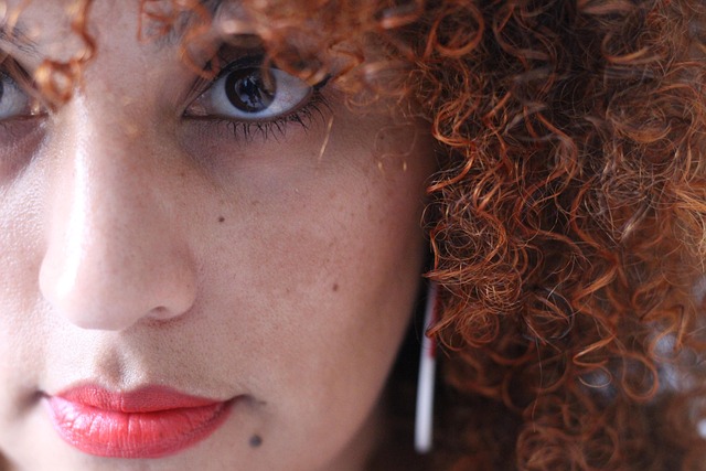 Hình ảnh minh họa ý nghĩa của từ melasma