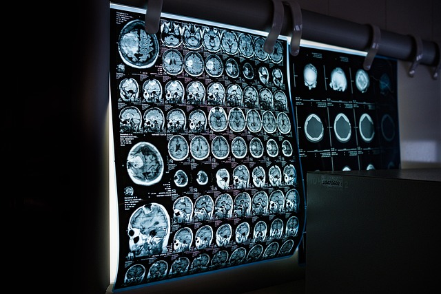 mri scan
