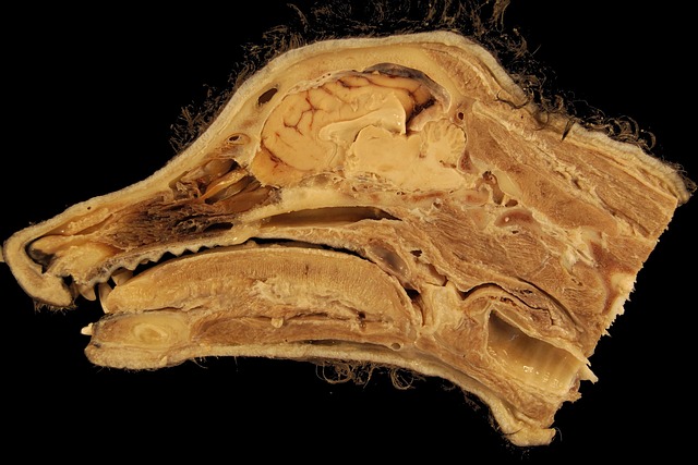 Hình ảnh minh họa ý nghĩa của từ nasal cavity