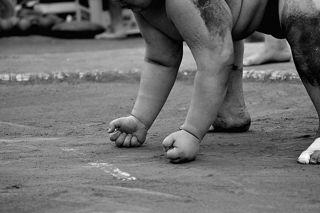 Hình ảnh minh họa ý nghĩa của từ obesity