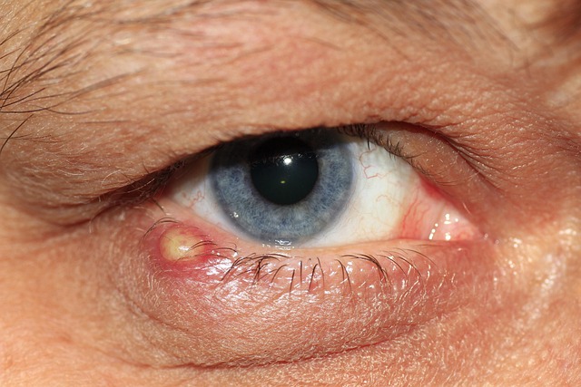 periodontal inflammation
