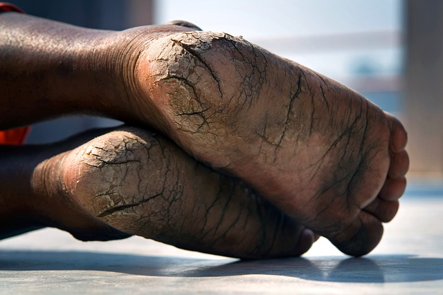skin condition
