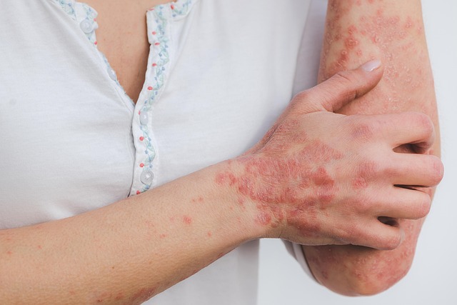 skin inflammation