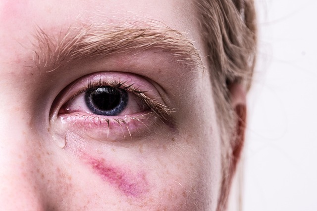 suffer injuries