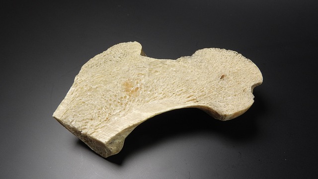 Hình ảnh minh họa ý nghĩa của từ tibia