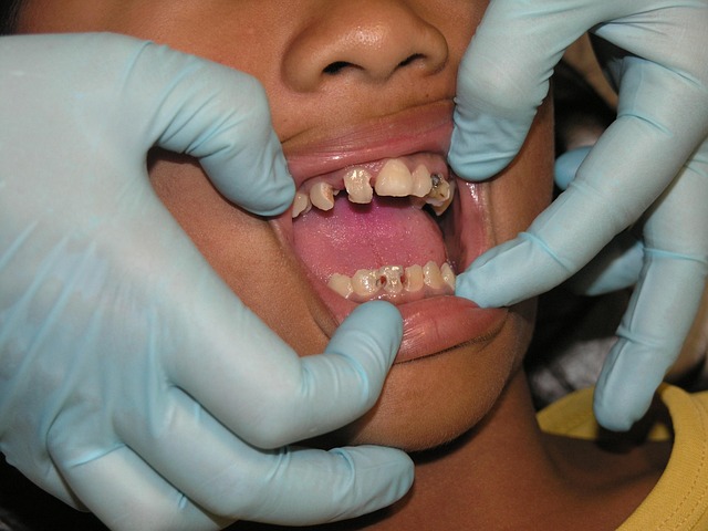 toothache