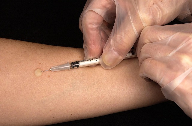 tuberculosis test