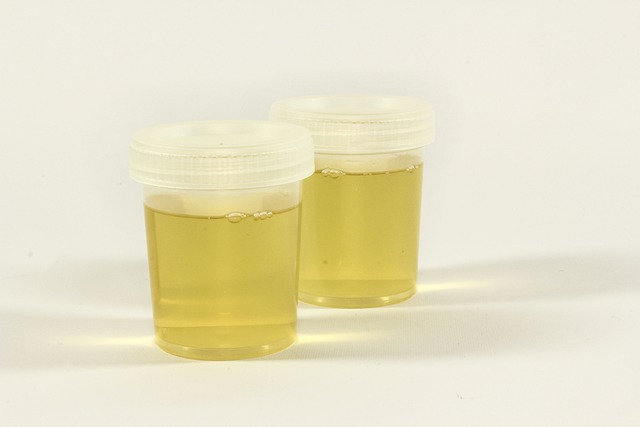 Hình ảnh minh họa ý nghĩa của từ urine