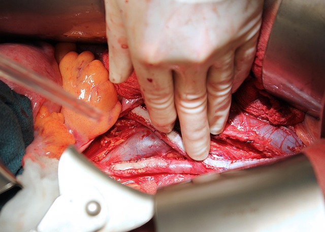 Hình ảnh minh họa ý nghĩa của từ vascular surgery