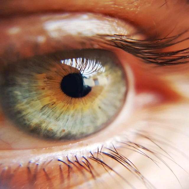 Hình ảnh minh họa ý nghĩa của từ yellowy